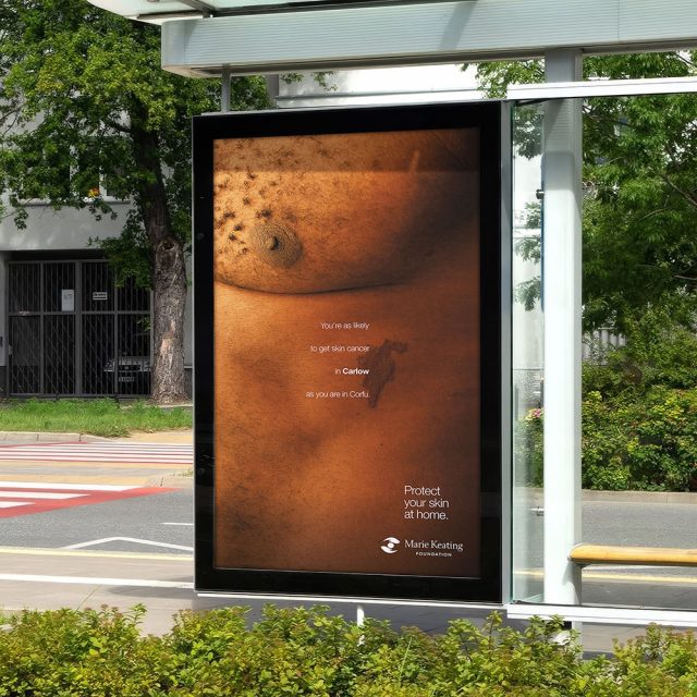 Marie Keating Foundation Maps Highlights Skin Cancer Risk in New Campaign